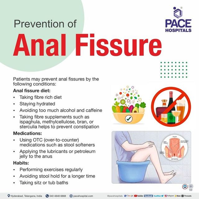 Anal Fissure Symptoms Causes Types Complications Prevention
